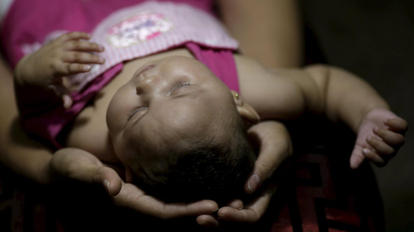 Gleyse Kelly holds the head of her daughter Maria Geovana, who has microcephaly, at his house in Recife
