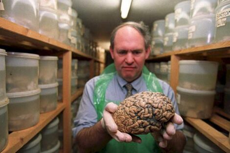 دماغ الإنسان - أرشيفية