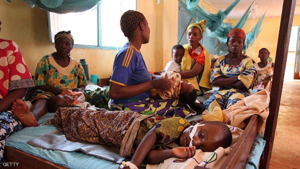 طفل تنزاني يعاني من الملاريا