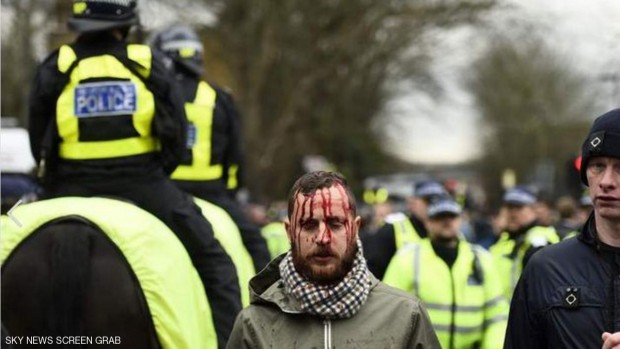 أحد المشجعين أصيب أثناء الاشتباكات